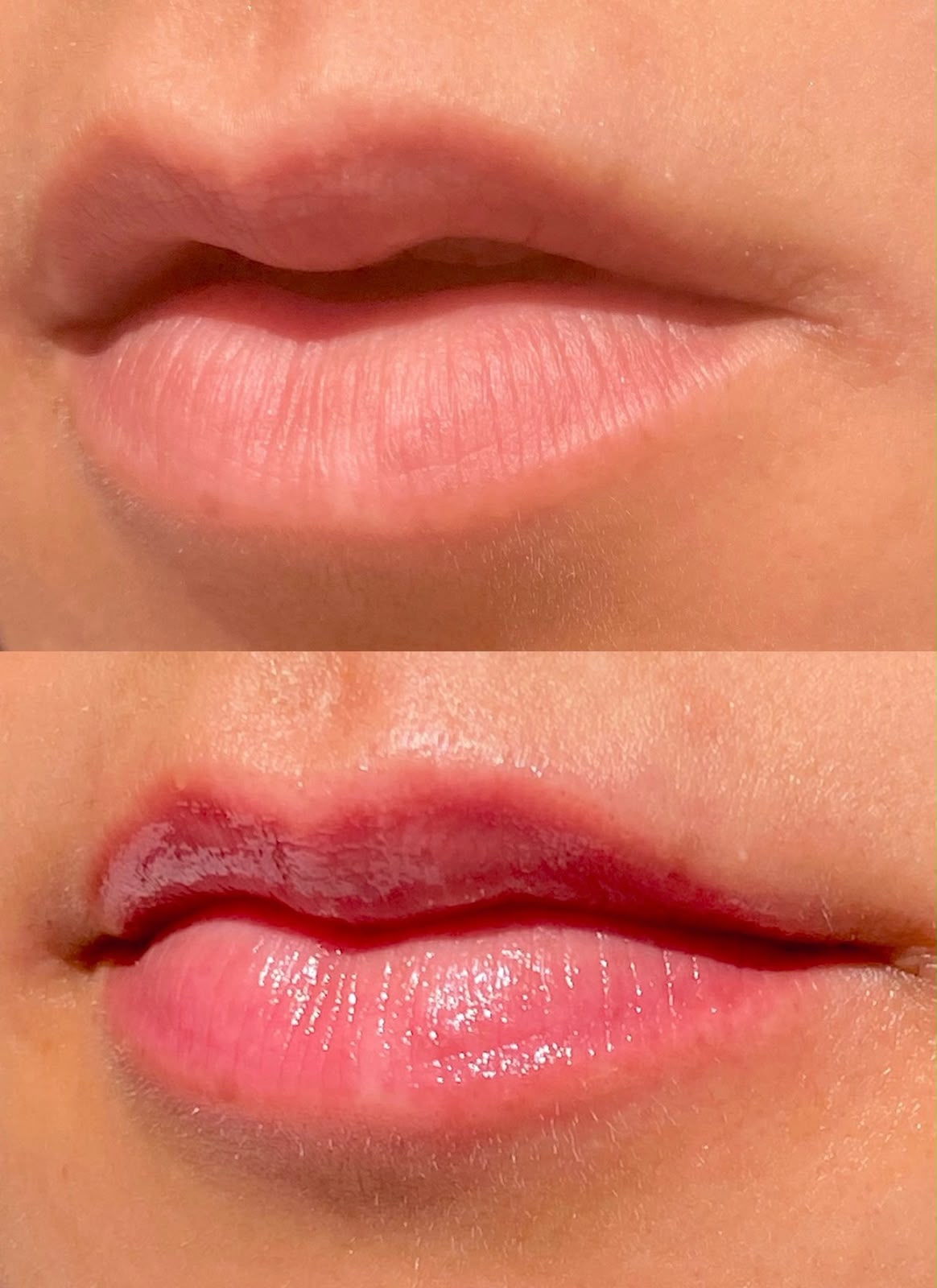 Hidragloss — resultado real
